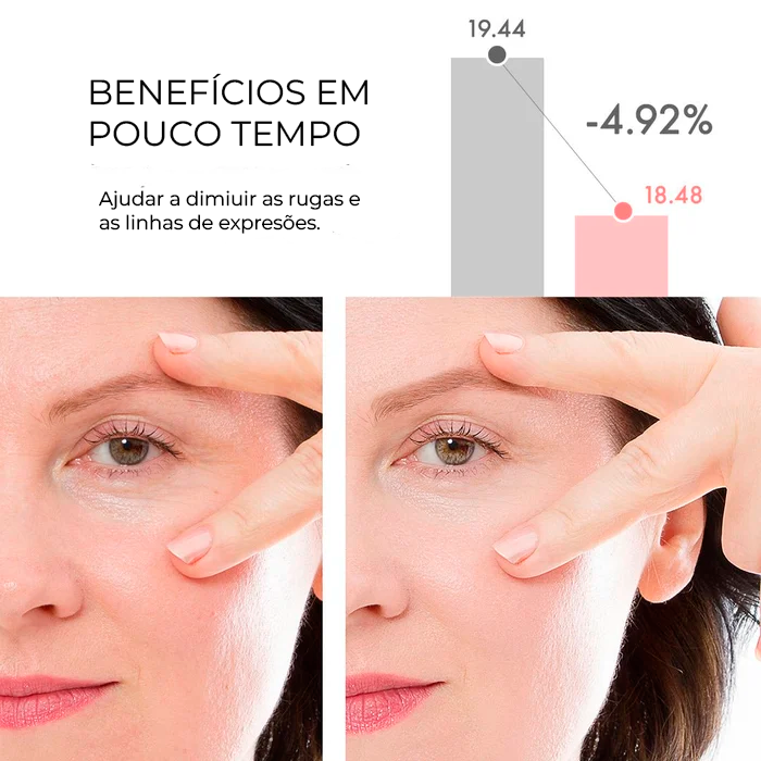 Anti-Age Rejuvenating Cream - Anti-Stain & Expression Lines™