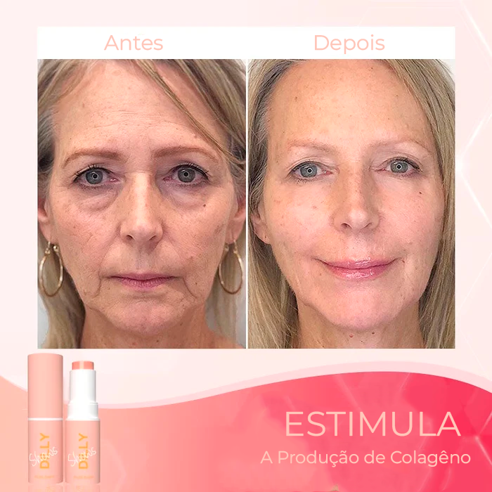 Anti-Age Rejuvenating Cream - Anti-Stain & Expression Lines™