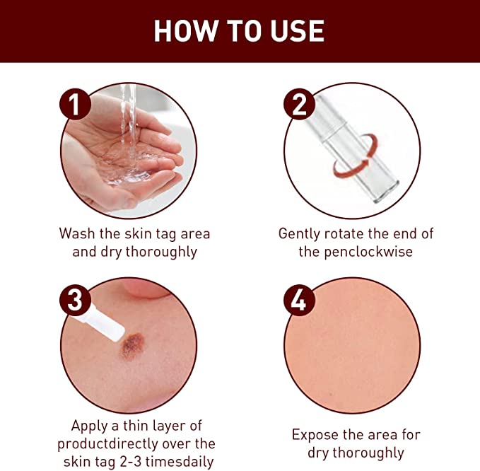 🔥Last Day Promotion 65% OFF🔥𝗤𝗩𝗖 recommends Tags & Moles Remover