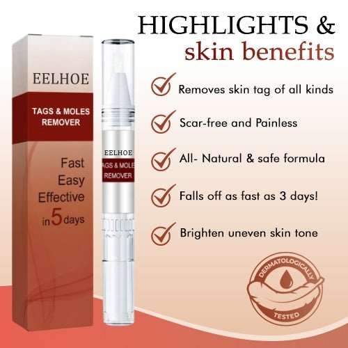 🔥Last Day Promotion 65% OFF🔥𝗤𝗩𝗖 recommends Tags & Moles Remover