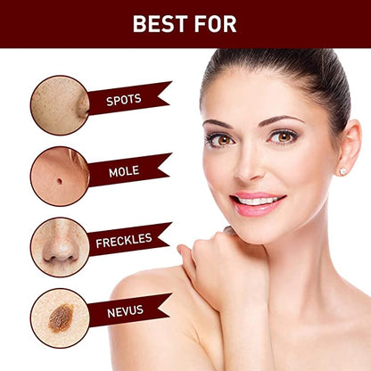 🔥Last Day Promotion 65% OFF🔥𝗤𝗩𝗖 recommends Tags & Moles Remover
